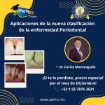 Aplicaciones de la nueva clasificación de la enfermedad Periodontal